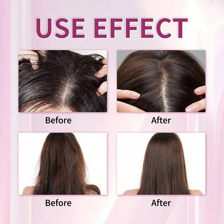 Pack of 2 YILEST Onion&Biotin And Rosemary Shampoo + Conditioner Set, Biotin And