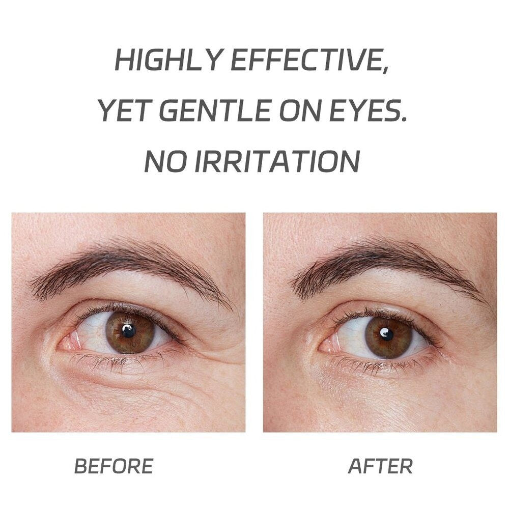 VGO Eye Cream, Eye Repair Cream Under Eye Cream for Dark Circles & Puffiness